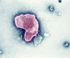 Virus respiratorio sincitial