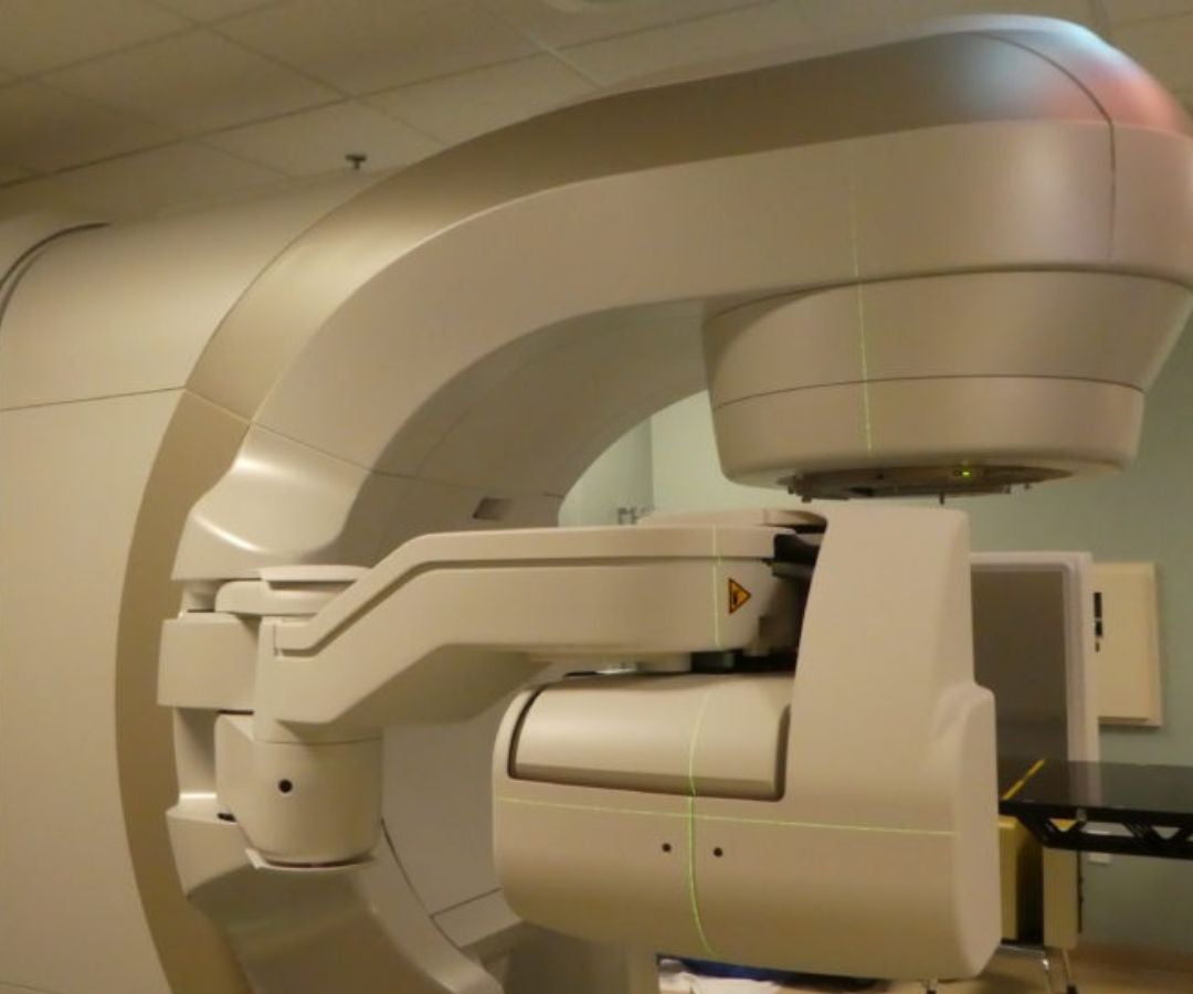 Software mejoraría la precisión de la radioterapia