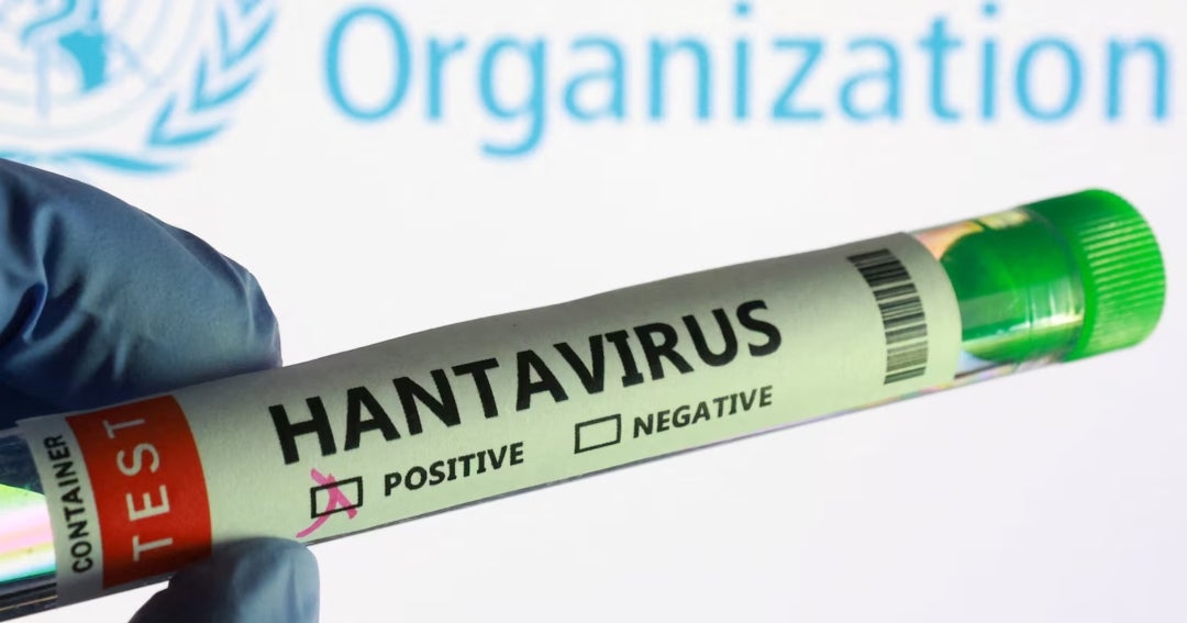 Un español en cuarentena da positivo por hantavirus, según Ministerio de Salud